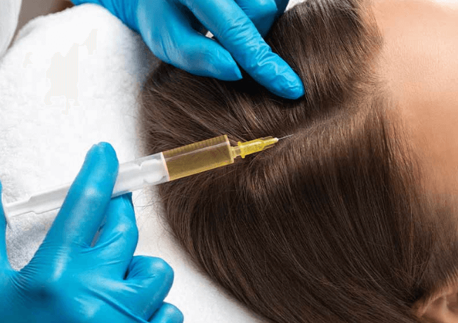 Is PRF the Future of Natural Hair Restoration?