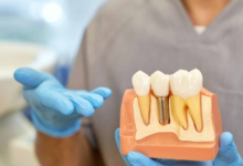 3 Advantages Of Visiting A Specialist For Implant Dentistry