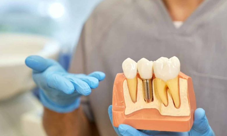 3 Advantages Of Visiting A Specialist For Implant Dentistry