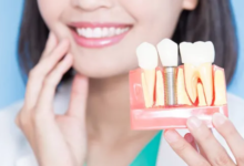 3 Signs You May Need Oral Surgery Before Dental Implants