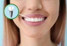 6 Cosmetic Dentistry Solutions Tailored To Busy Families