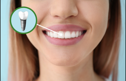 6 Cosmetic Dentistry Solutions Tailored To Busy Families