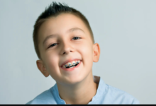 3 Key Advantages Of Interceptive Orthodontics In Childhood