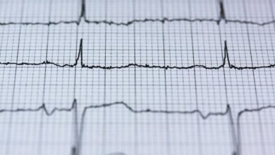 infinity pulse conversion node identifiers
